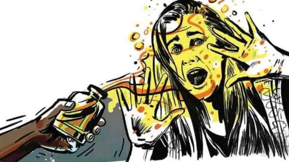 देवास - पति ने दूसरी पत्नी के ऊपर फेका एसिड,हालत गंभीर,जिला अस्पताल में भर्ती 1 acid attack